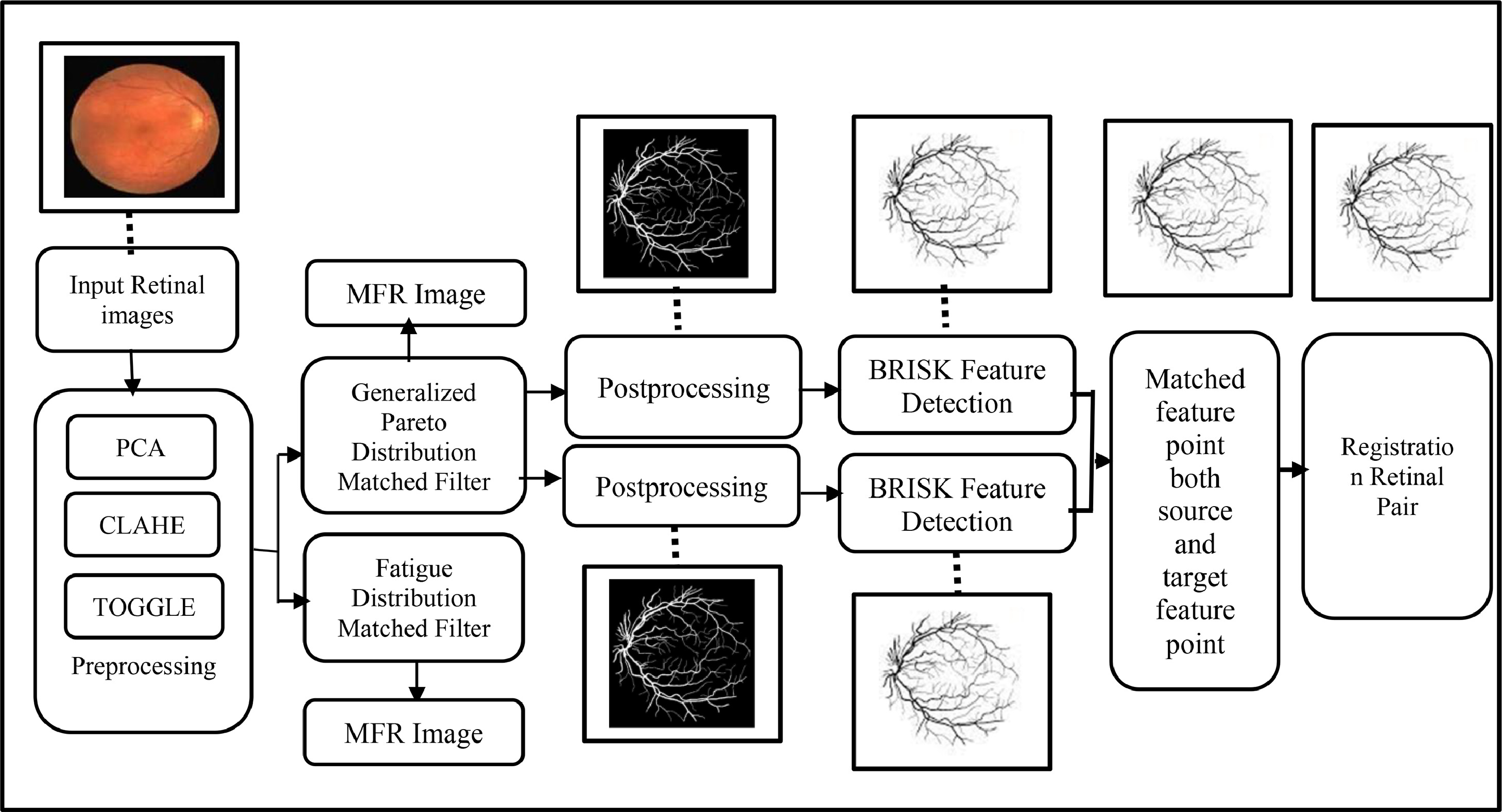 An efficient registration-based approach for retinal blood vessel ...