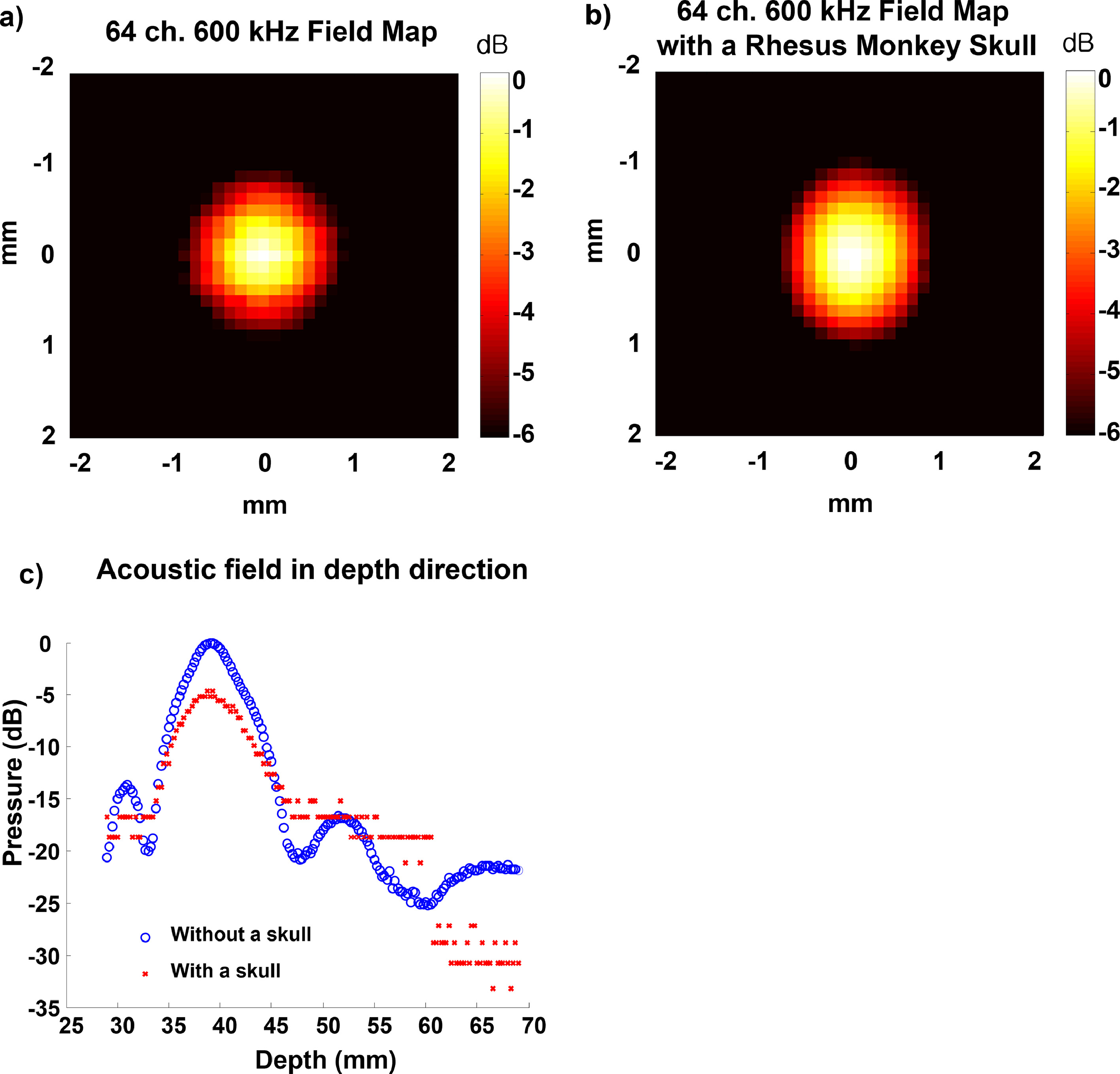 A phased array ultrasound system with a robotic arm for neuromodulation ...