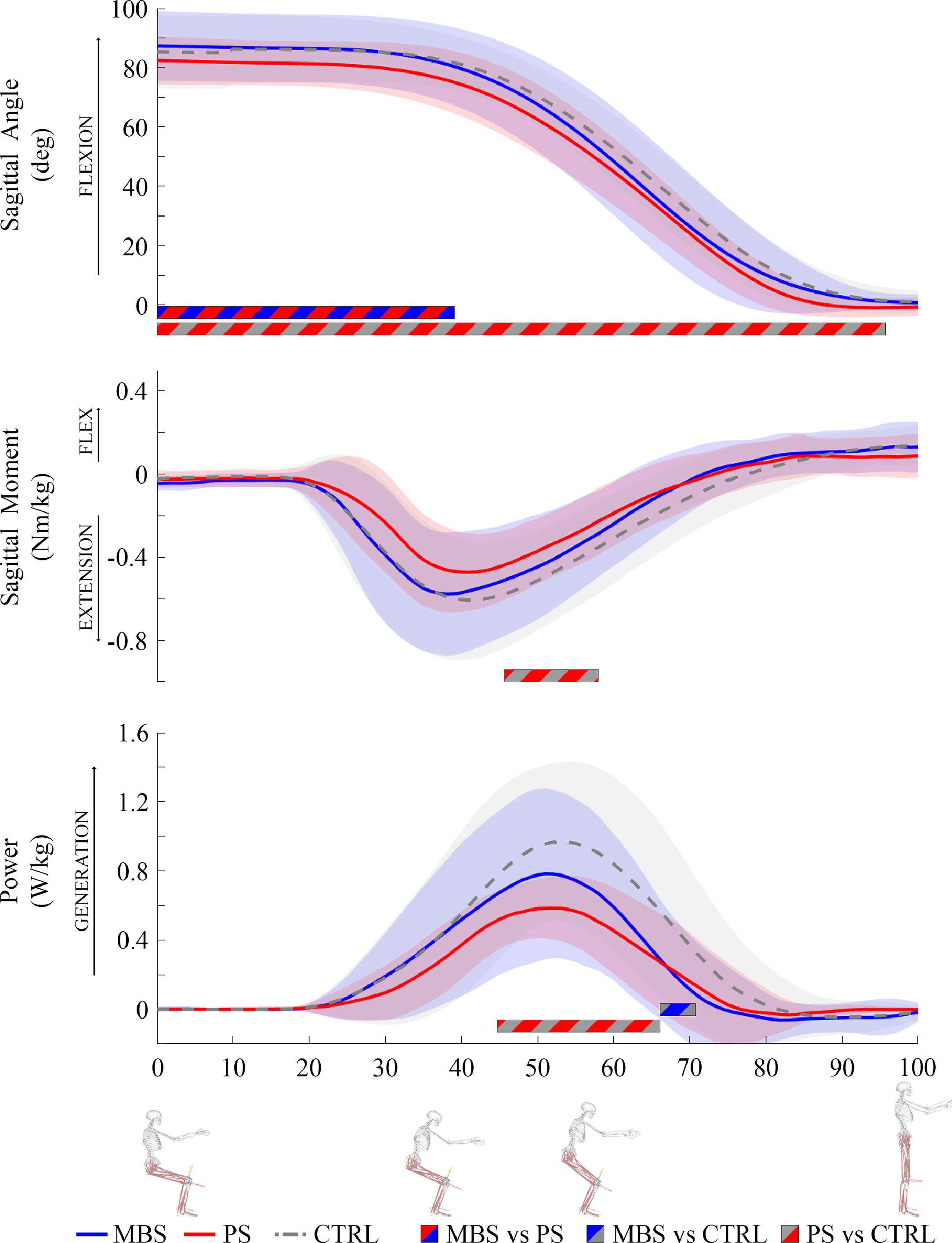 Medial and lateral knee contact forces and muscle forces during sit-to ...