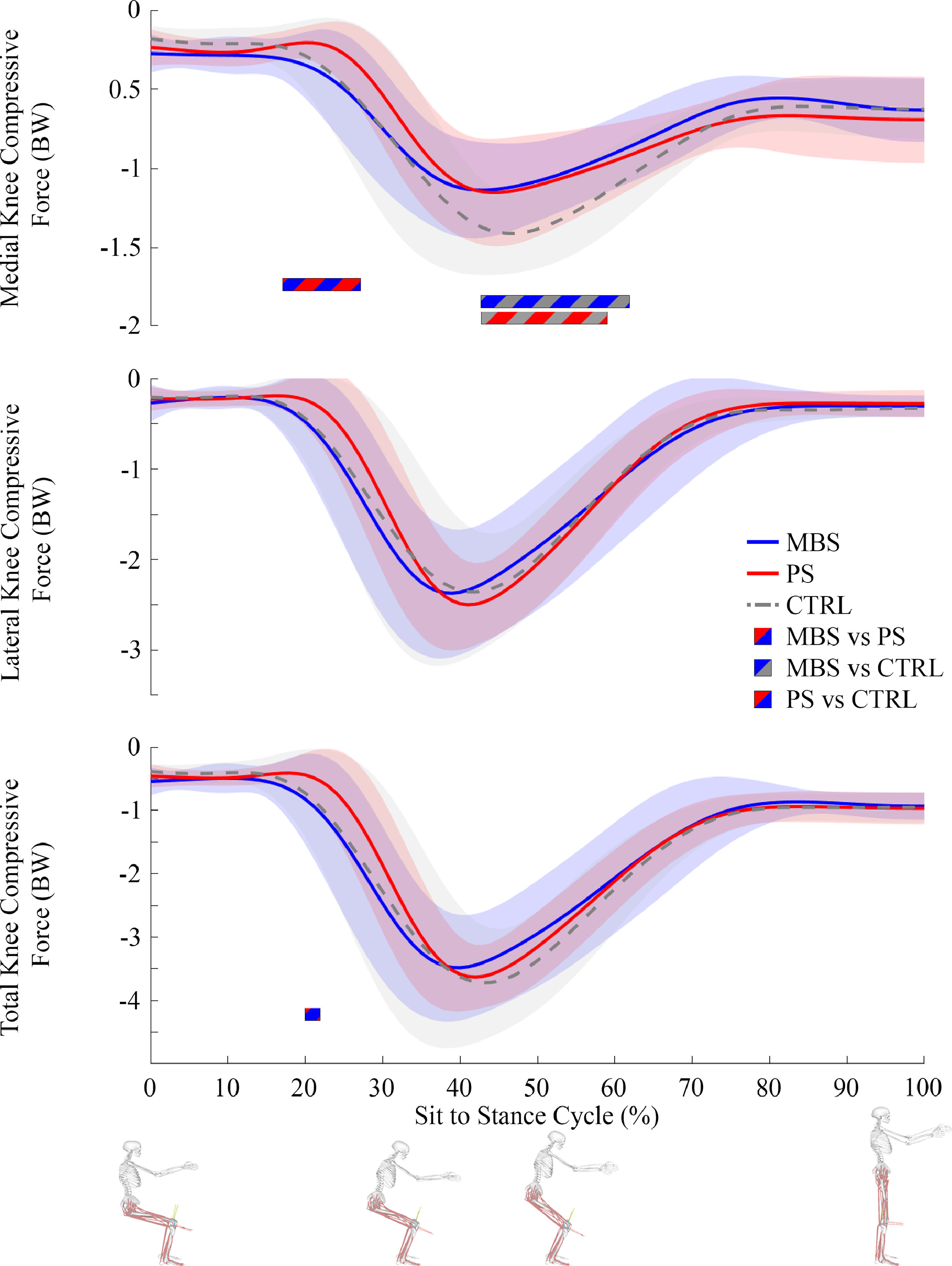 Medial and lateral knee contact forces and muscle forces during sit-to ...