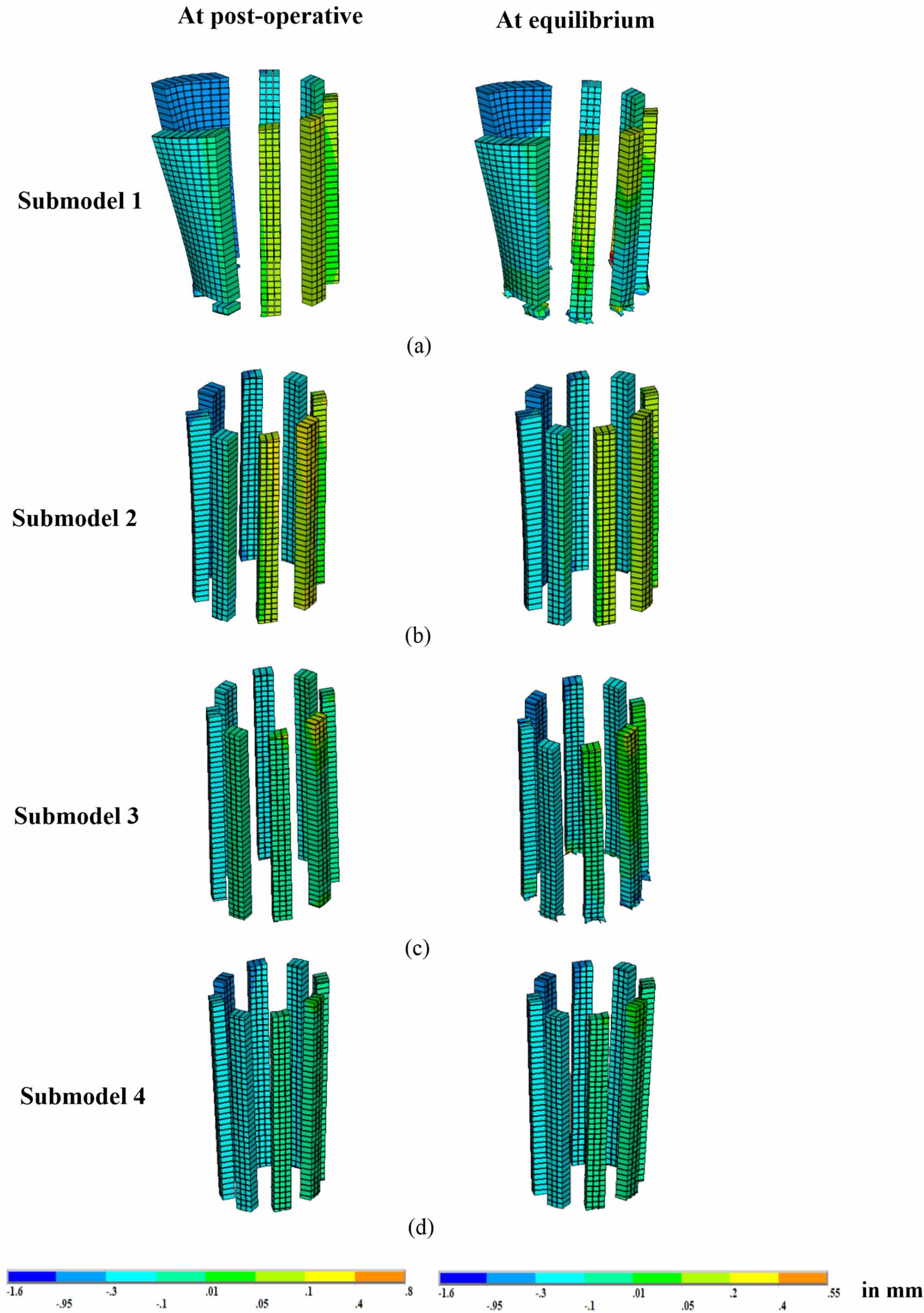 The effect of bone remodelling on bone ingrowth into a novel porous hip ...