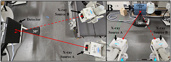Msv Setups Using a monoplane stereoscopic videoradiography configuration to ...
