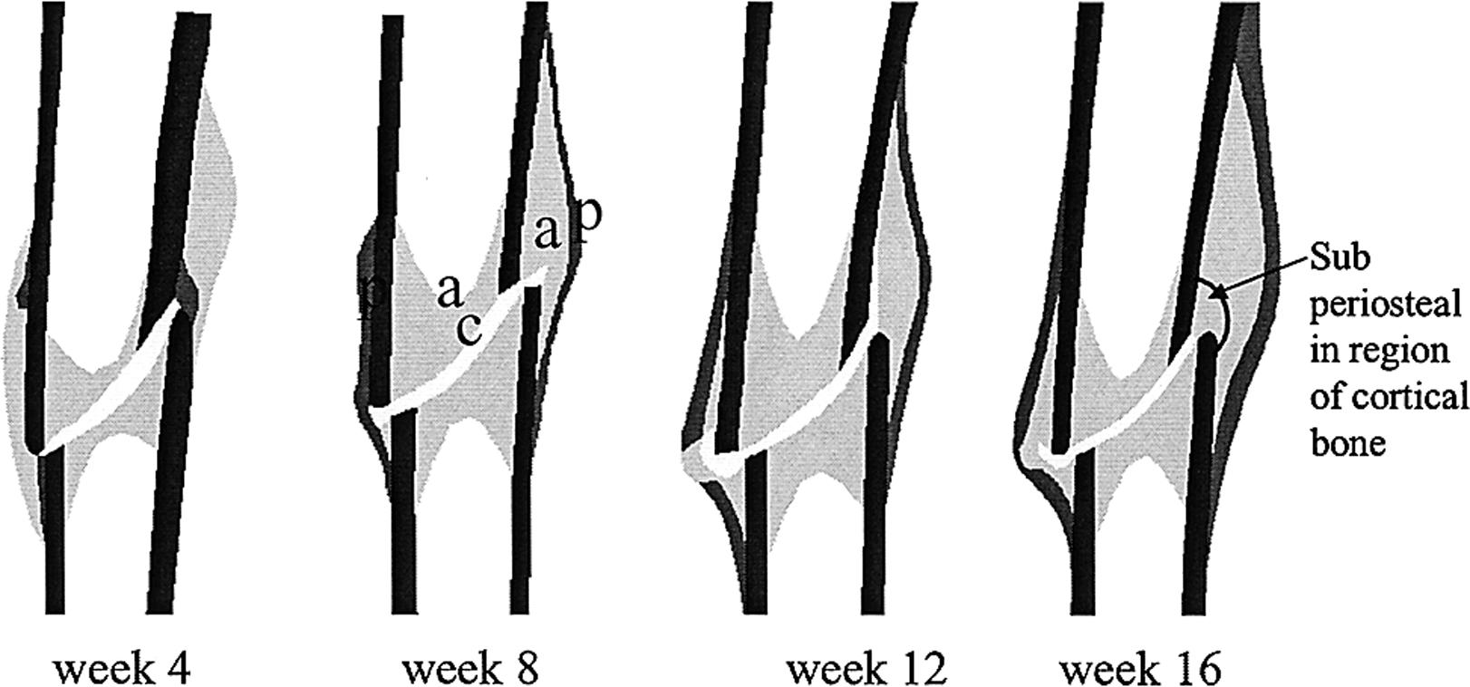 The role of osteogenic index, octahedral shear stress and dilatational ...