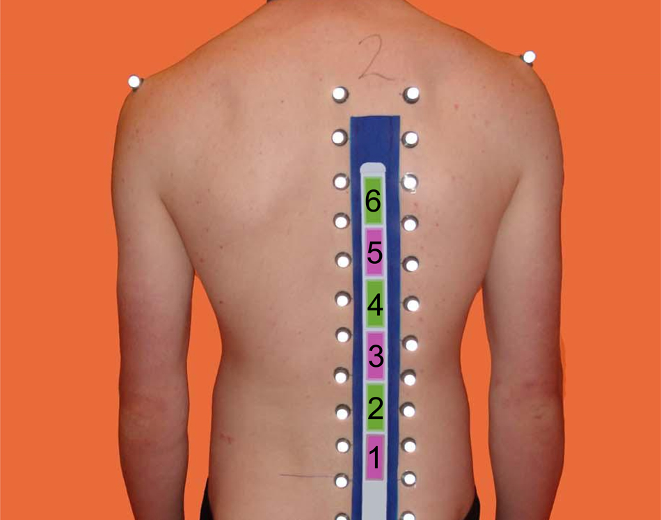 A novel system for the dynamic assessment of back shape - IOPscience