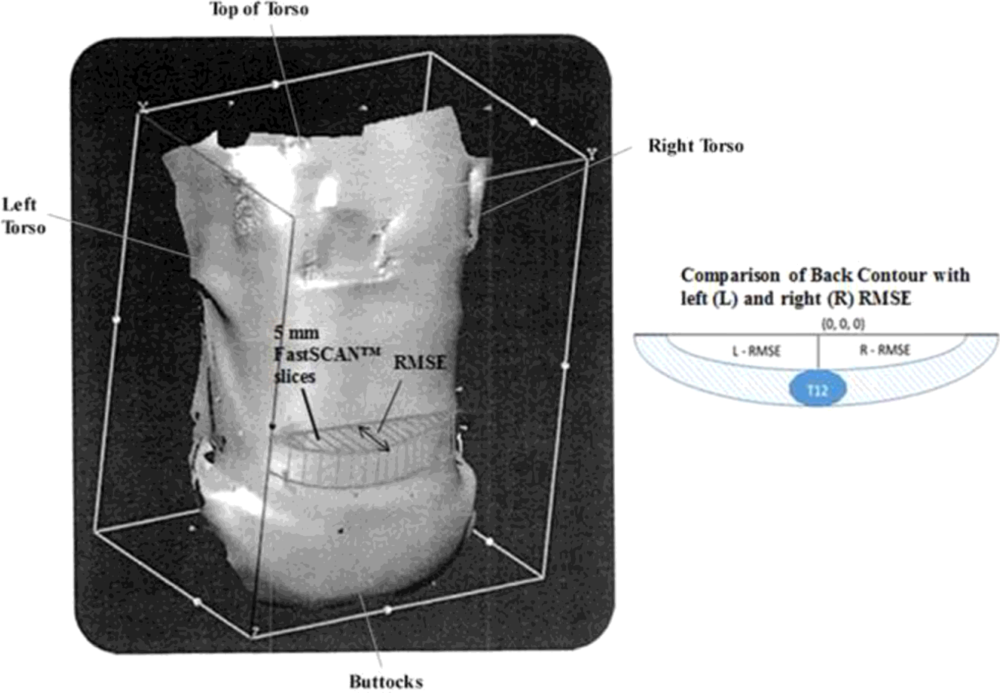 Human Back Spring Identification Identifying characteristic back shapes from anatomical scans of ...
