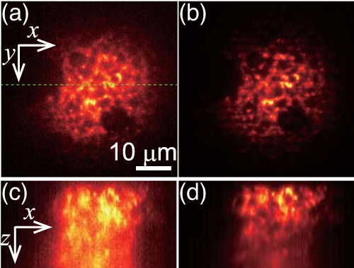 Enhancement of optical sectioning capability of temporal focusing ...