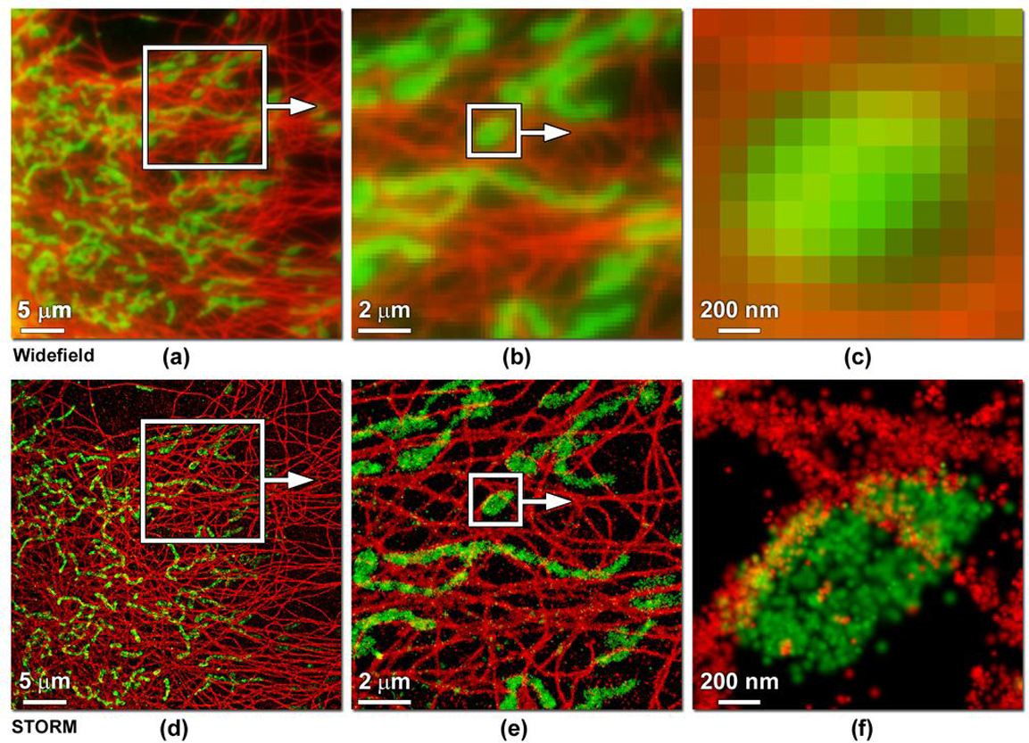 Single molecule localization microscopy for superresolution - IOPscience