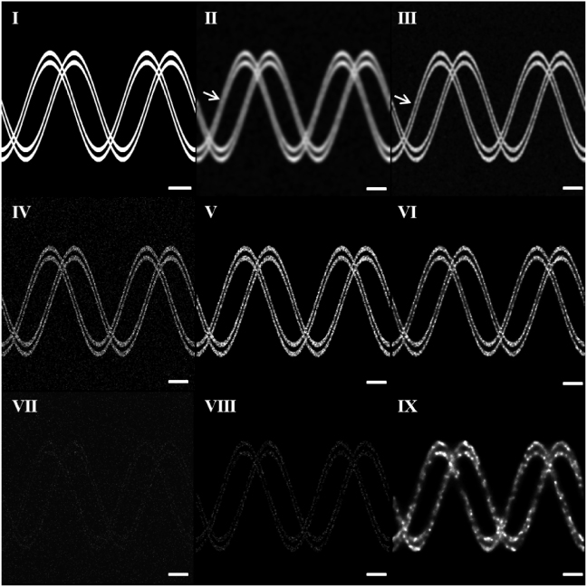 Combination of structured illumination and single molecule localization ...