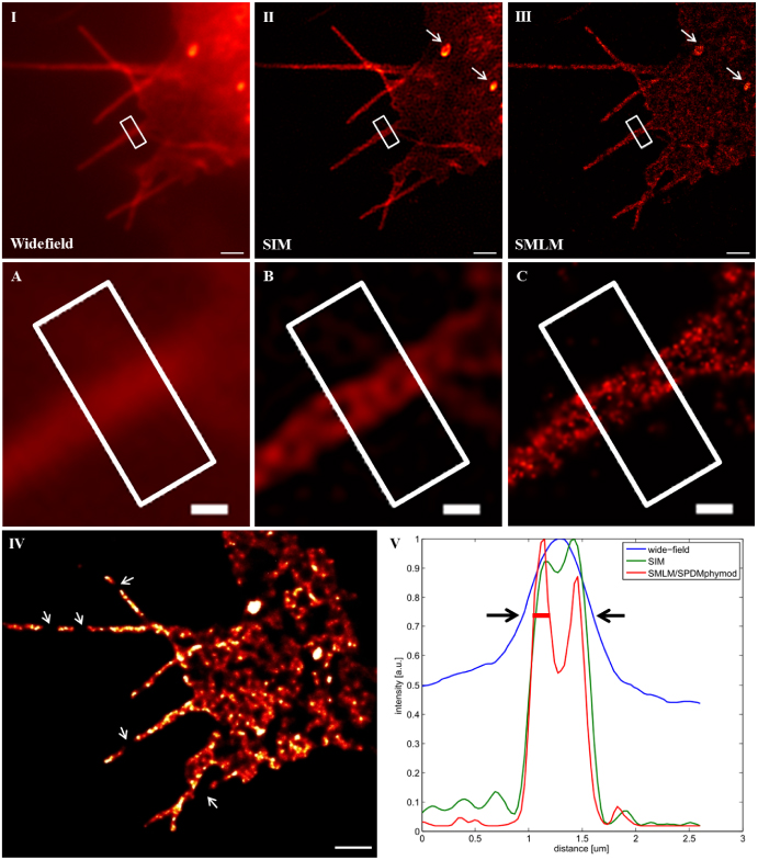 Combination of structured illumination and single molecule localization ...
