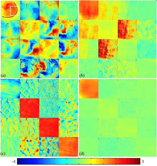 A review of polarization-based imaging technologies for clinical and ...