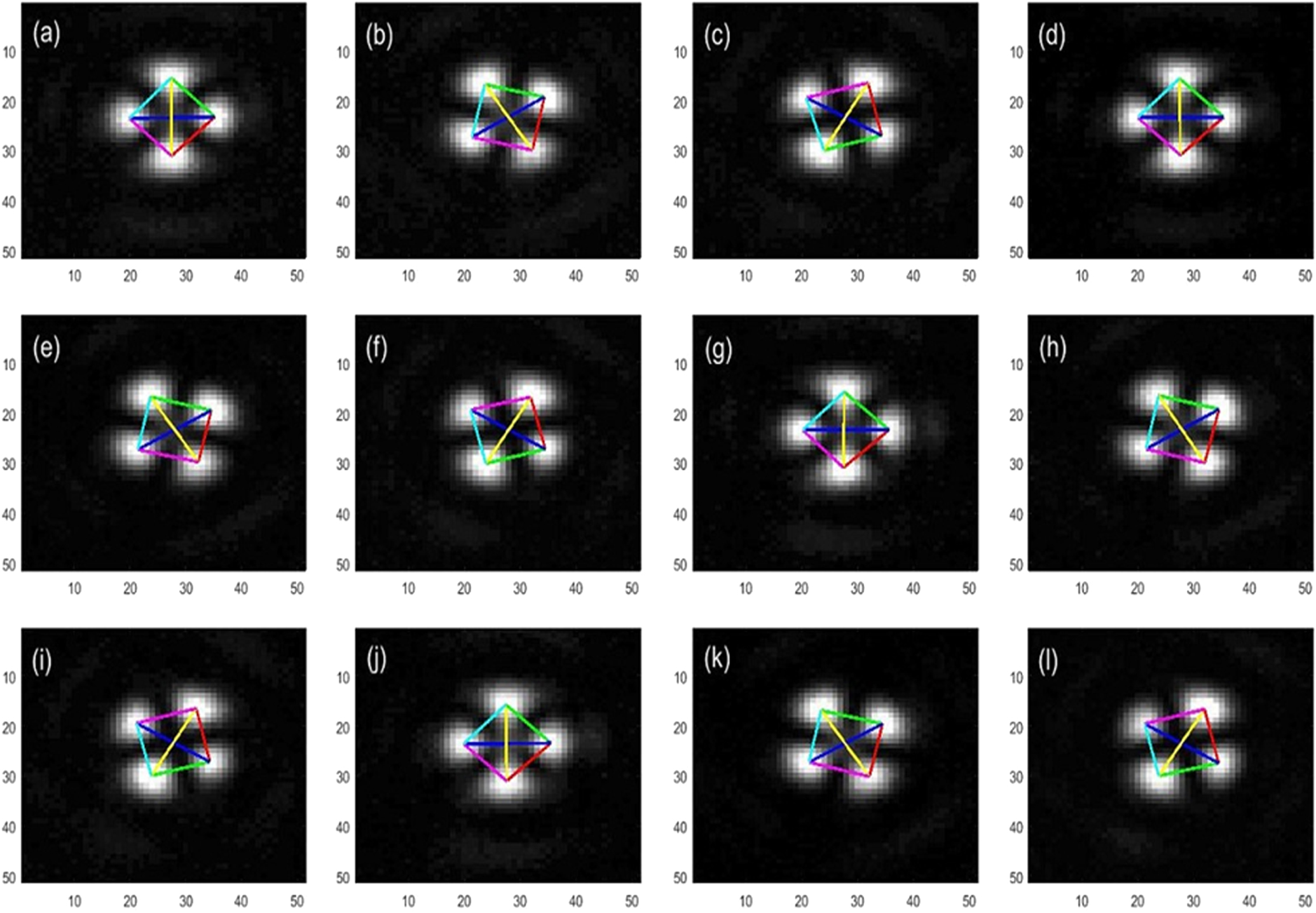 Vortex Slm Pattern Radial-shearing interferometry for phase LC-SLM calibration with a pair ...