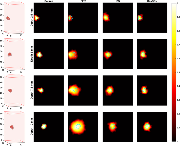 Reconstruction of fluorescence molecular tomography based on graph ...