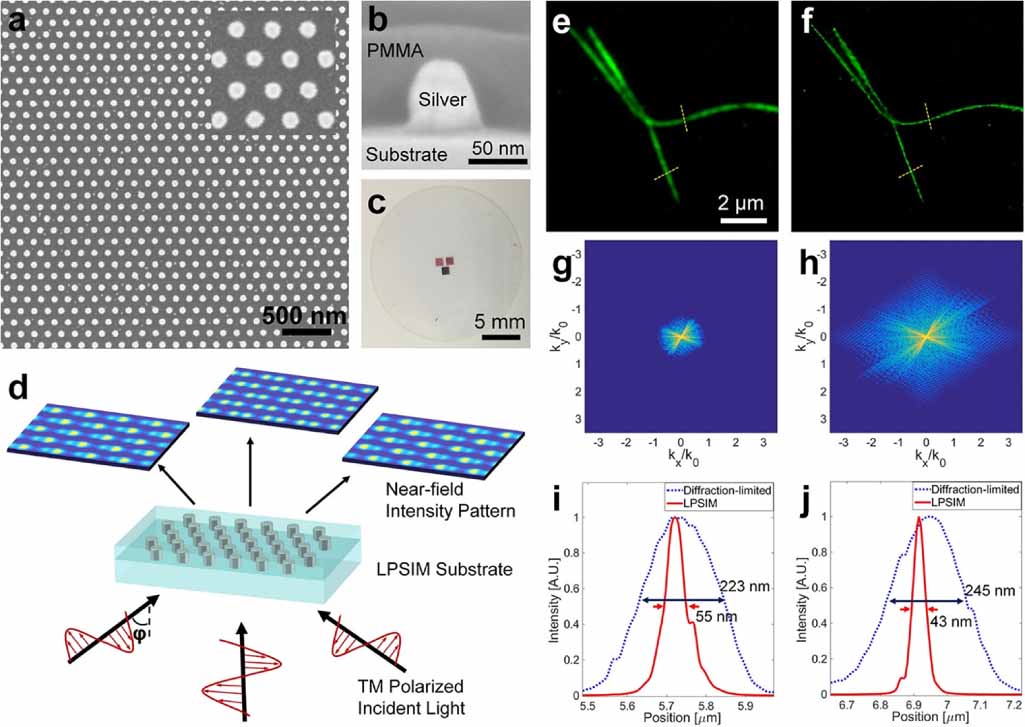 An overview of structured illumination microscopy: recent advances and ...