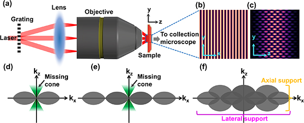 An overview of structured illumination microscopy: recent advances and ...