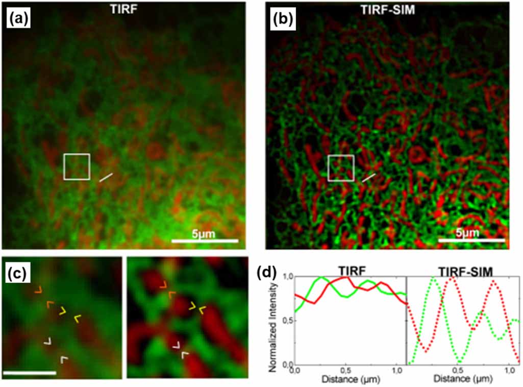 An overview of structured illumination microscopy: recent advances and ...