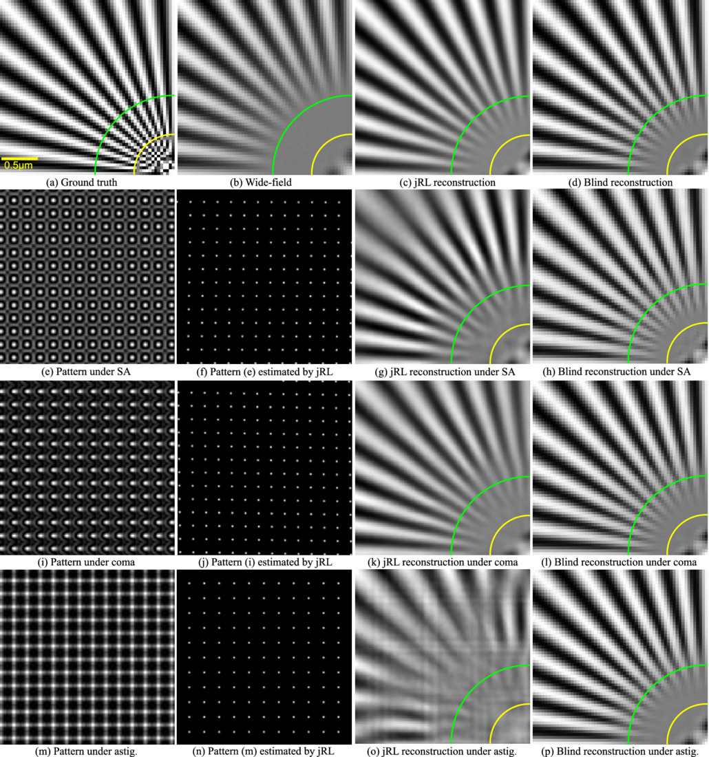 A blind reconstruction approach for multifocal structured illumination ...
