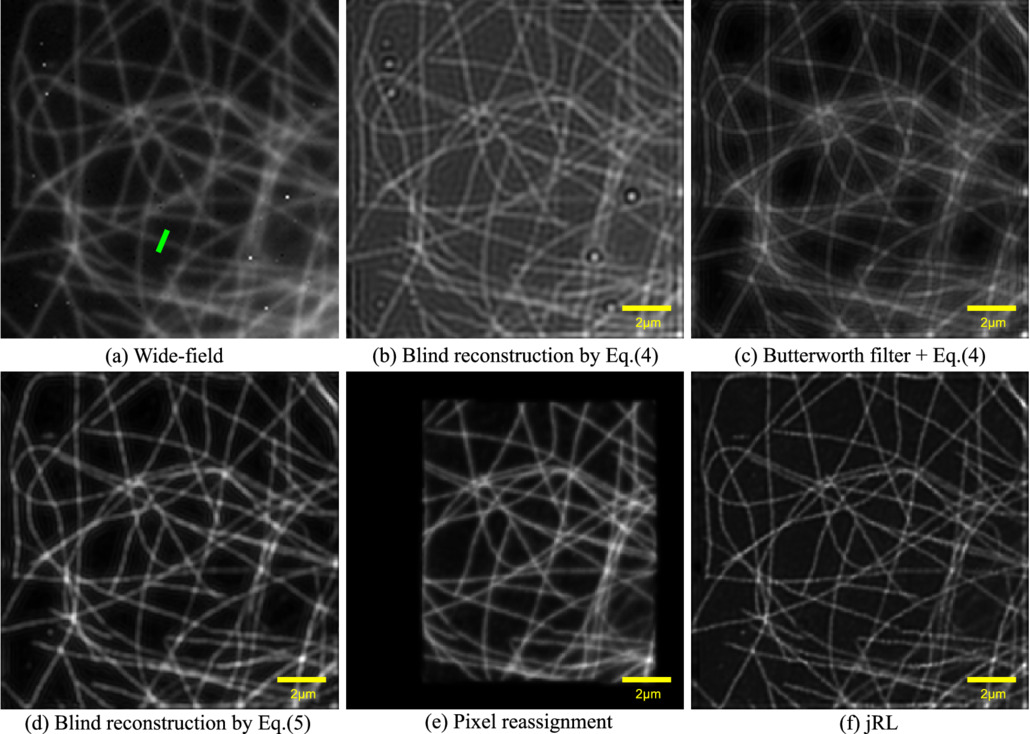 A blind reconstruction approach for multifocal structured illumination ...