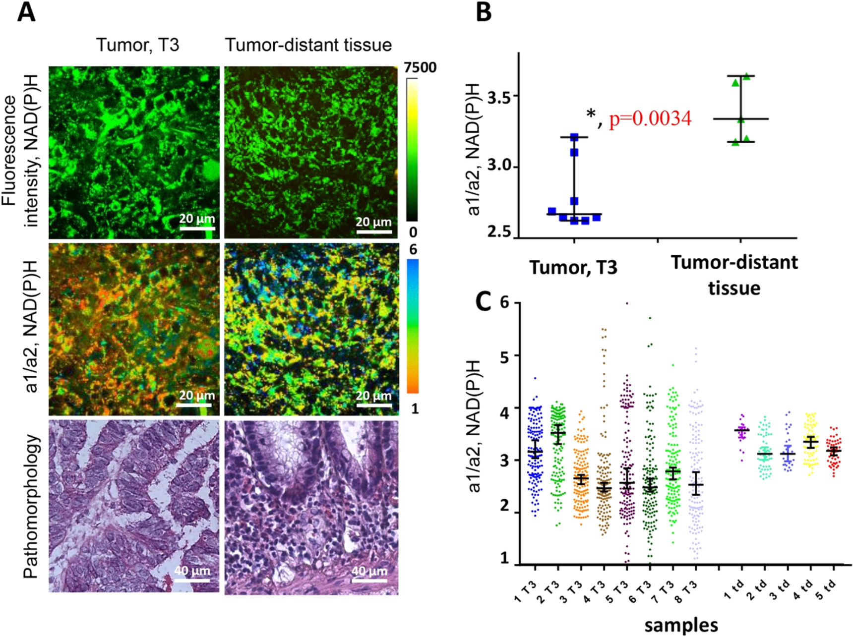 Interrogation of tumor metabolism in tissue samples ex vivo using ...