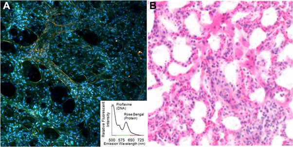 Using FDA-approved drugs as off-label fluorescent dyes for optical ...