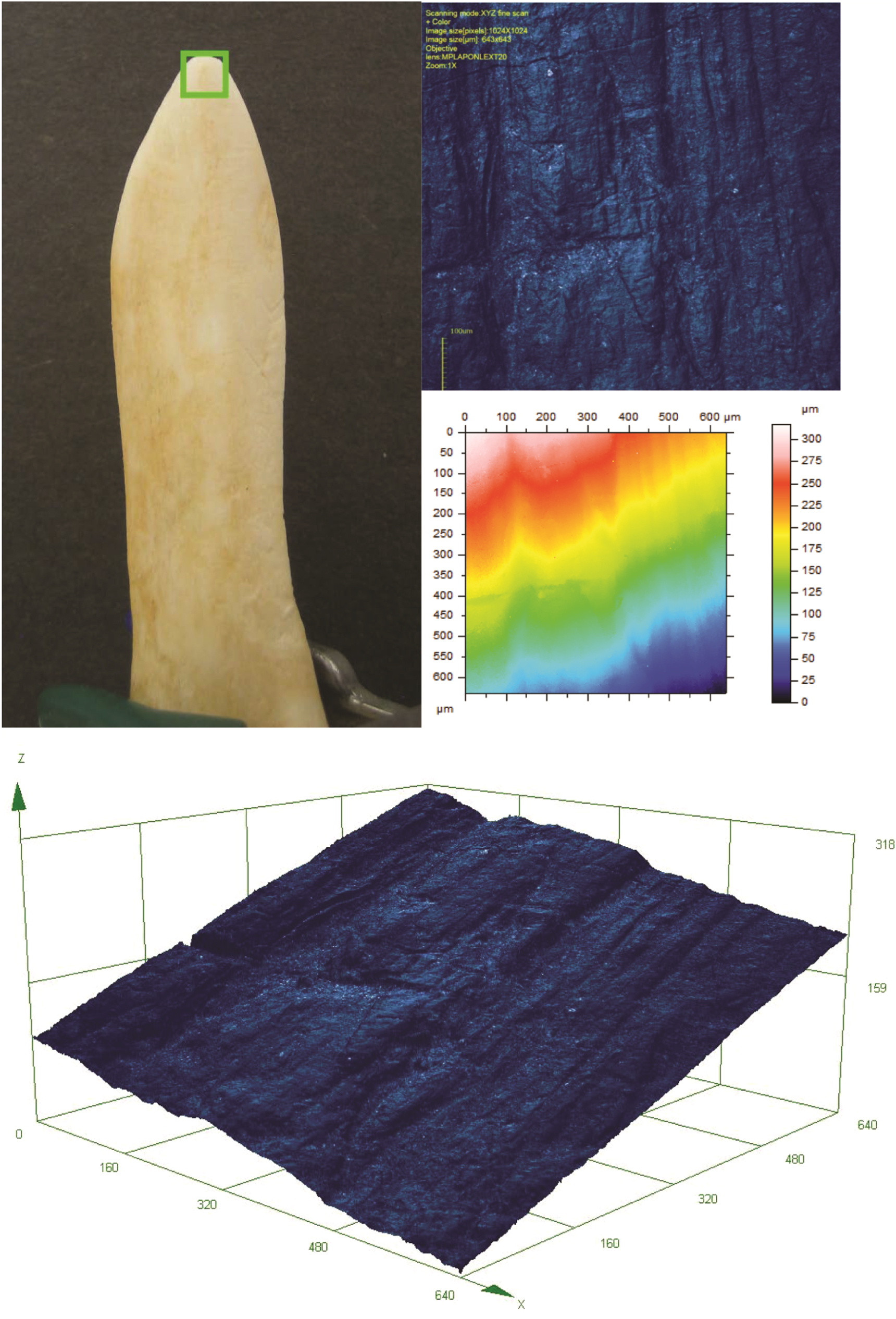 A comparative assessment of texture analysis techniques applied to bone ...