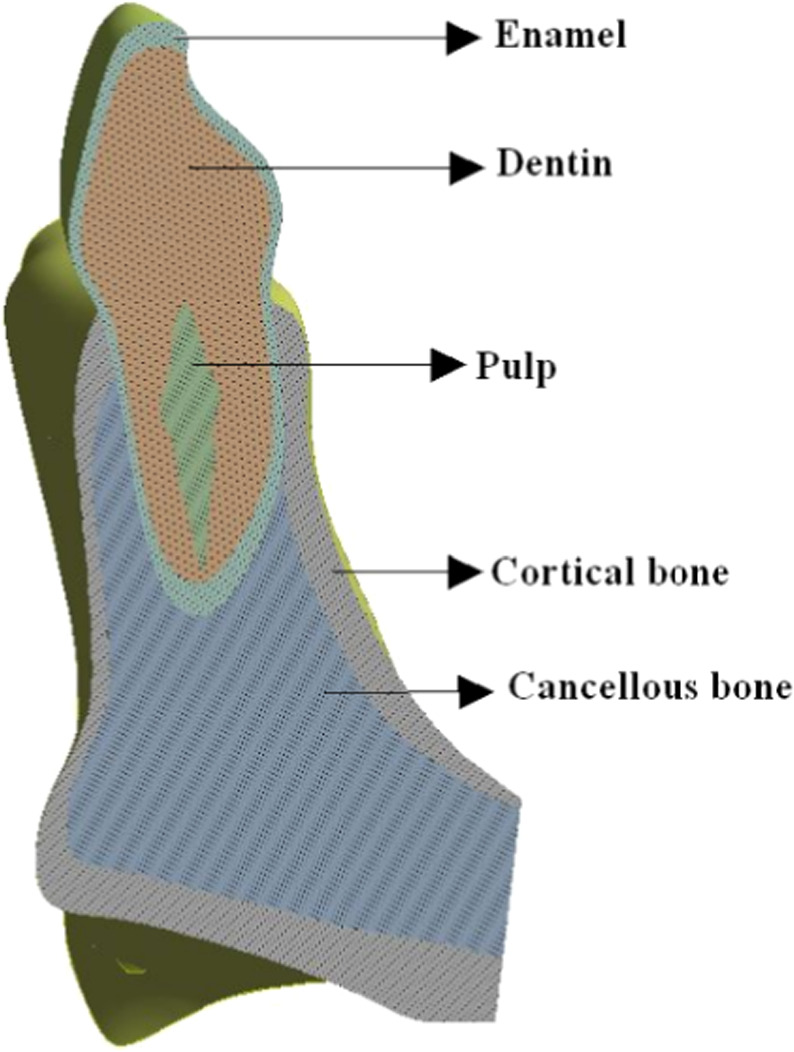 Investigating dental structure response to air abrasion: a finite ...