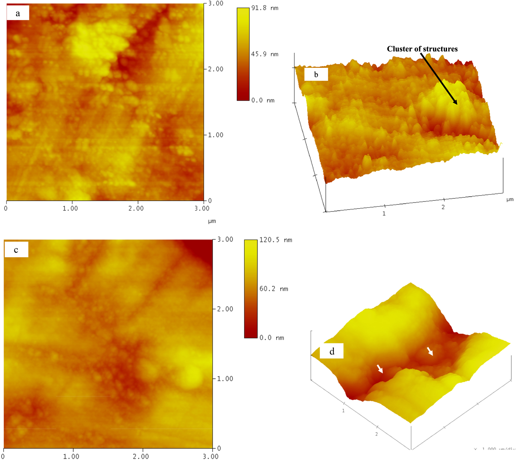Atomic force microscopy analysis of surface topography of pure thin ...