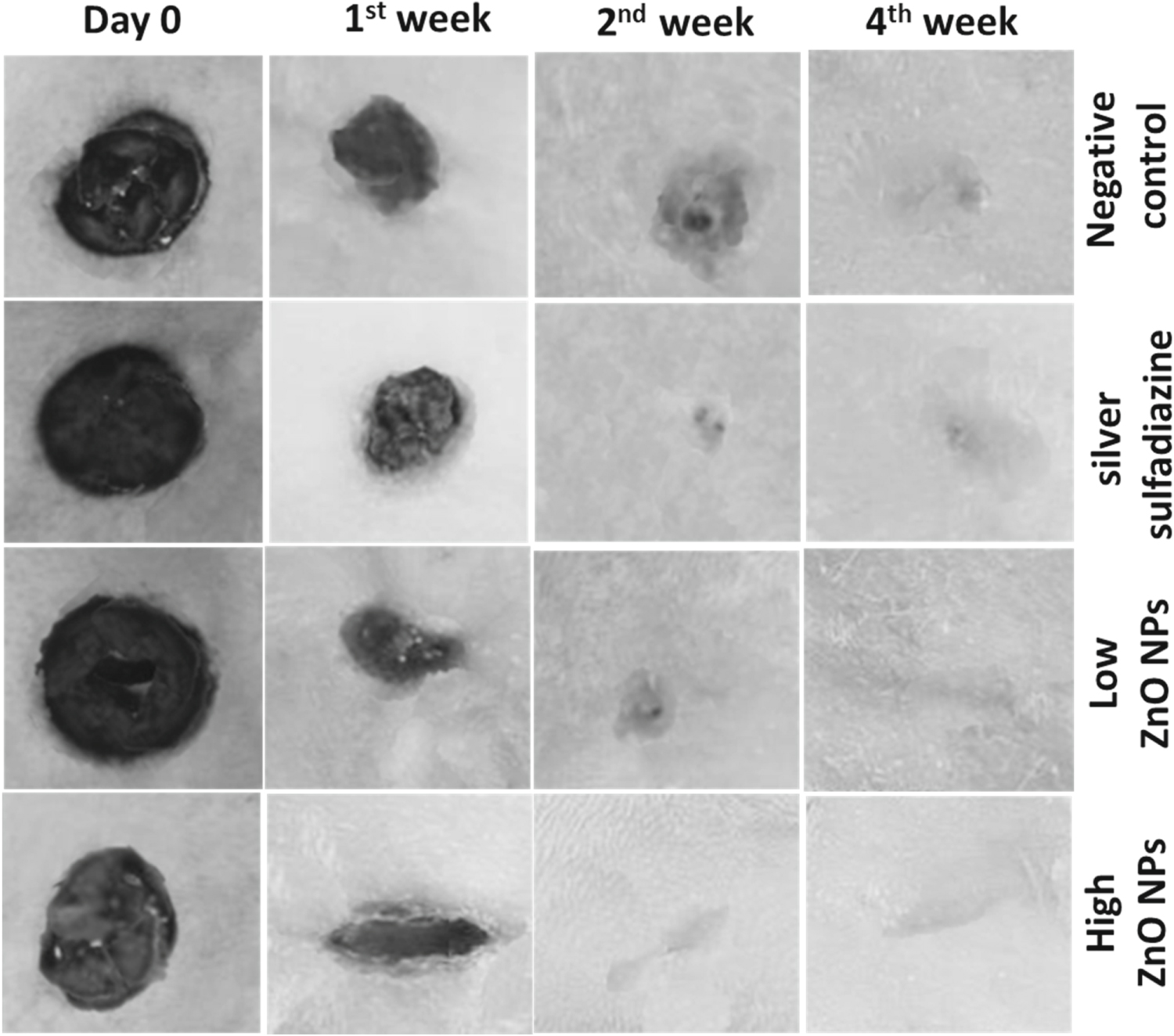 Biosynthesis of Zinc oxide nanoparticles and their application for ...