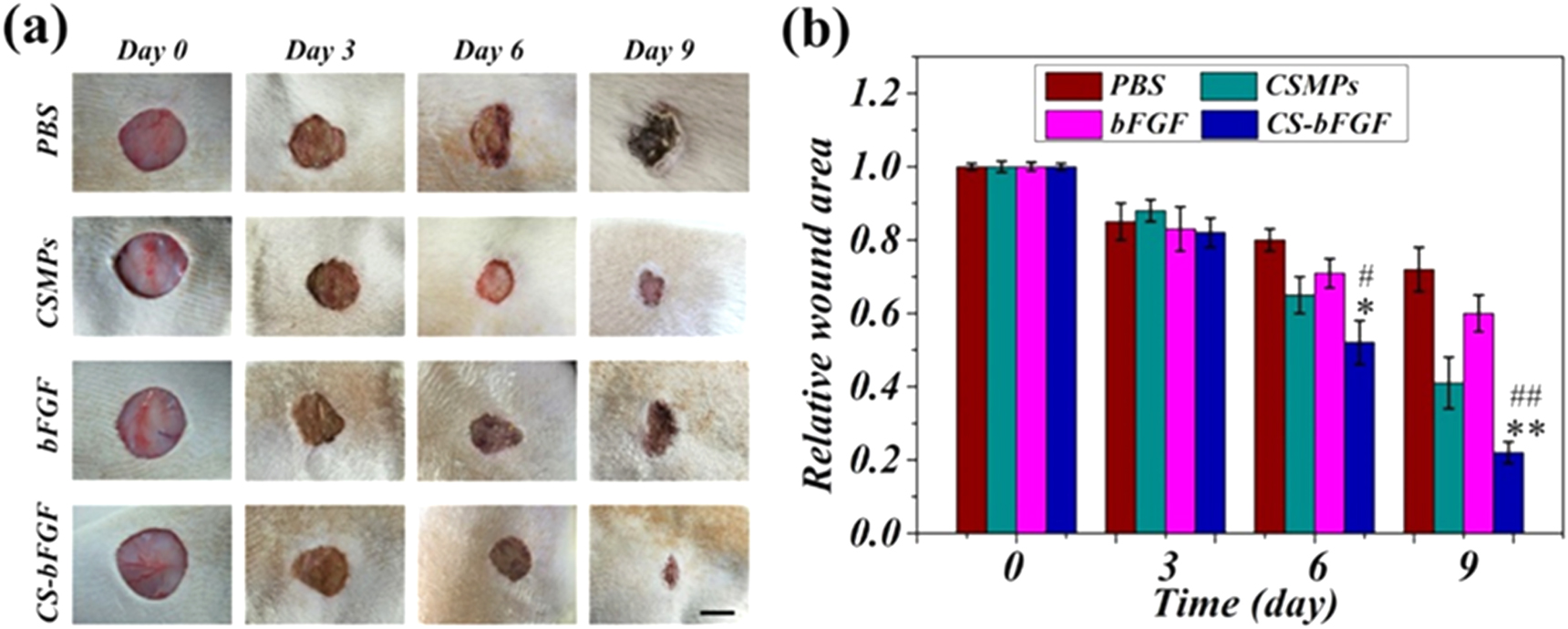 Antibacterial hydrogel microparticles with drug loading for wound ...