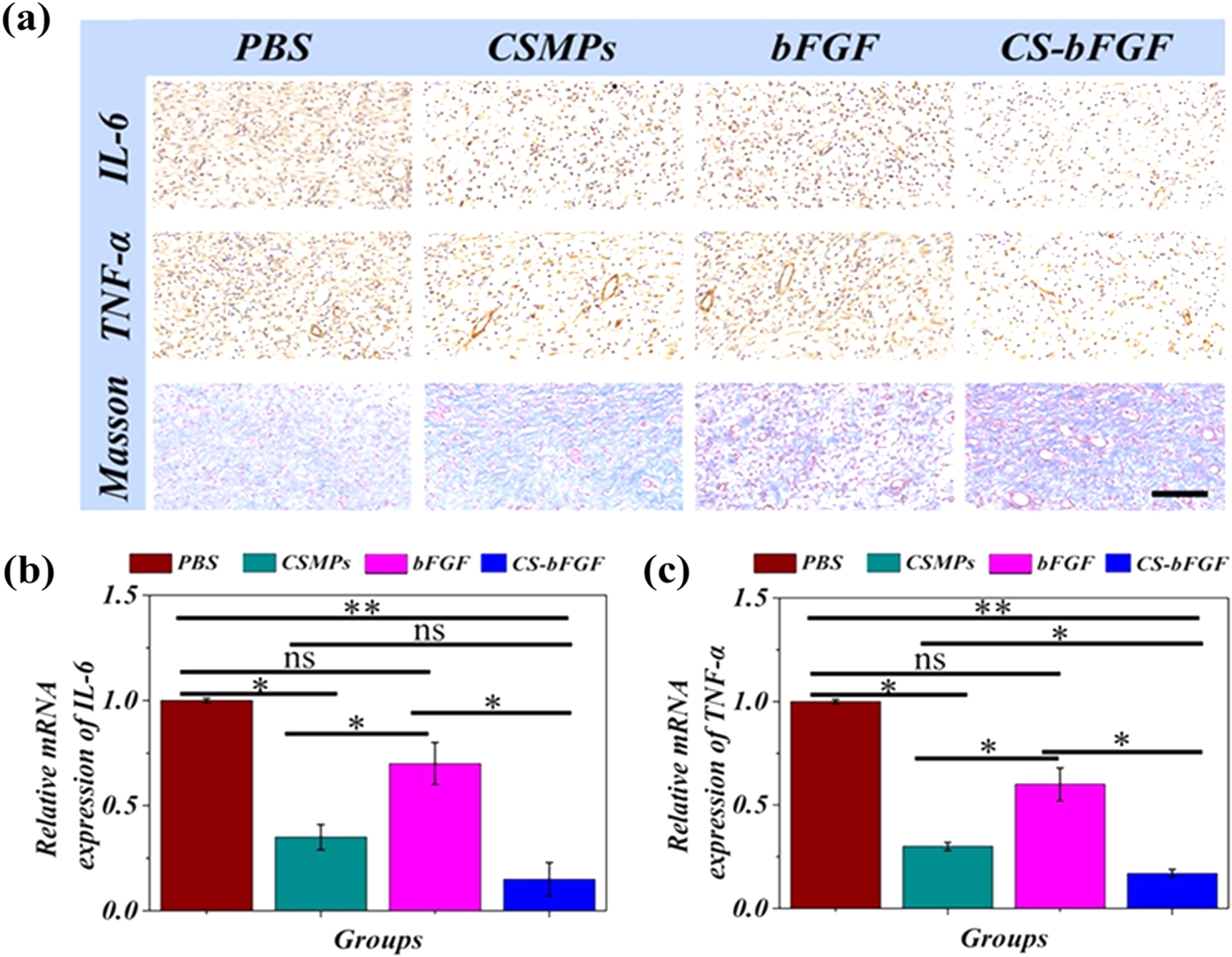 Antibacterial hydrogel microparticles with drug loading for wound ...