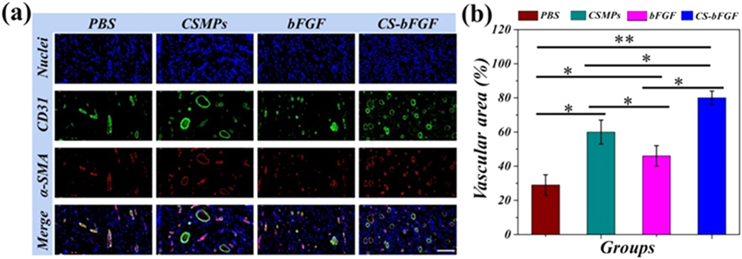 Antibacterial hydrogel microparticles with drug loading for wound ...