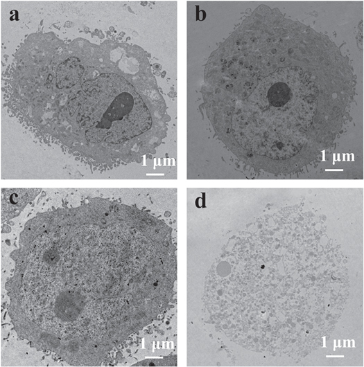 Redox-responsive mesoporous silica nanoparticles for chemo ...