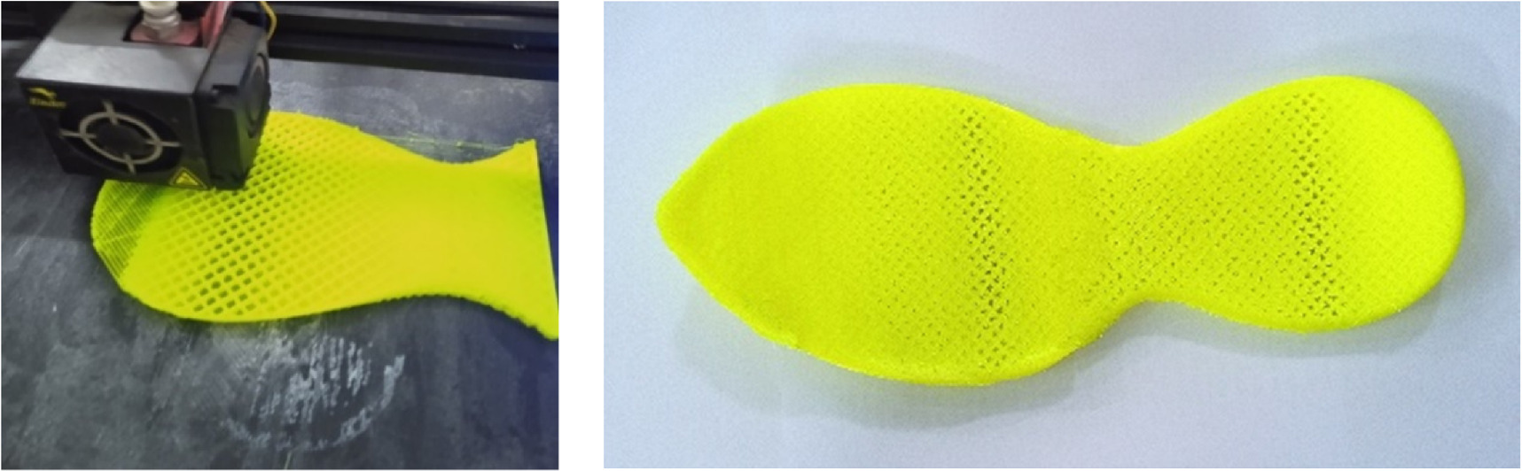 3D Printed customized diabetic foot insoles with architecture designed ...