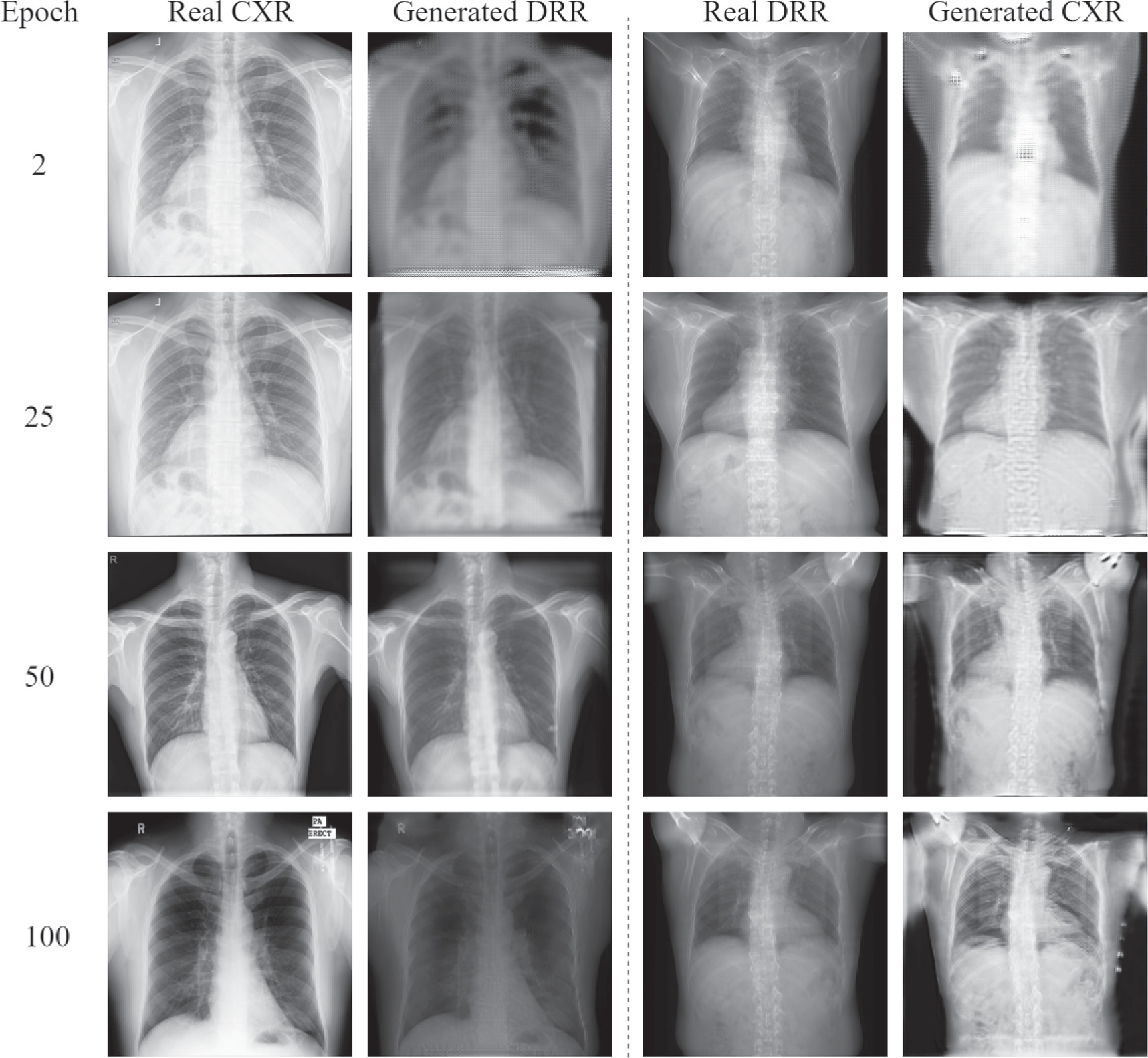 X Ray Rib Count Rib segmentation in chest x-ray images based on unsupervised domain ...