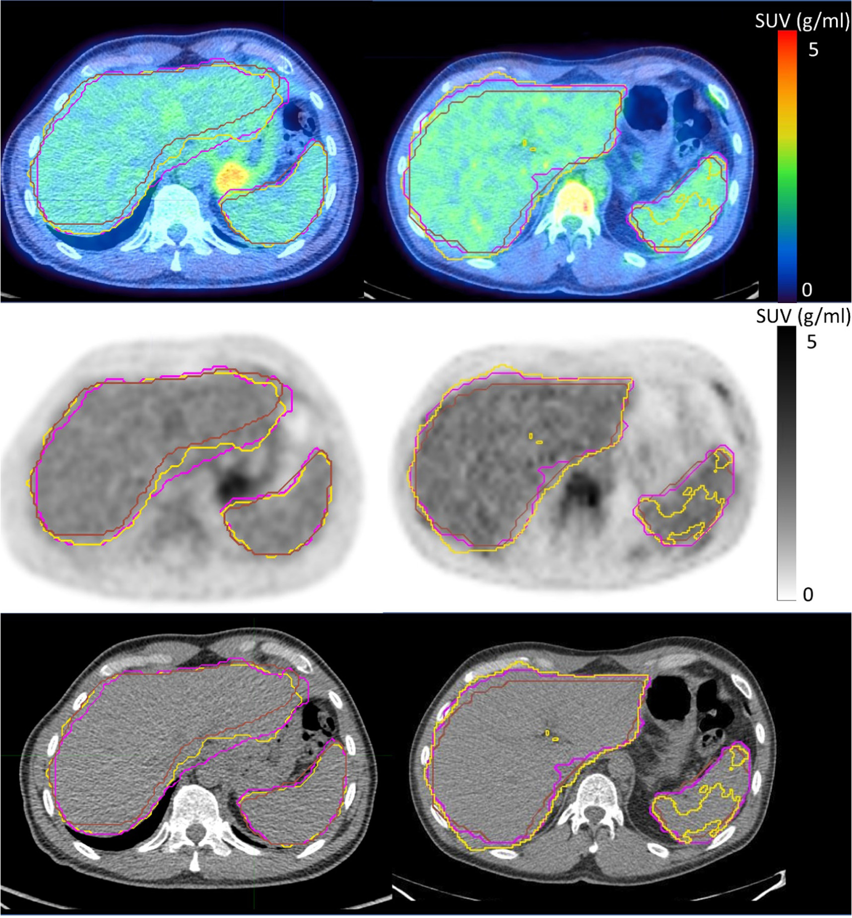 Evaluation of manual and automated approaches for segmentation and ...
