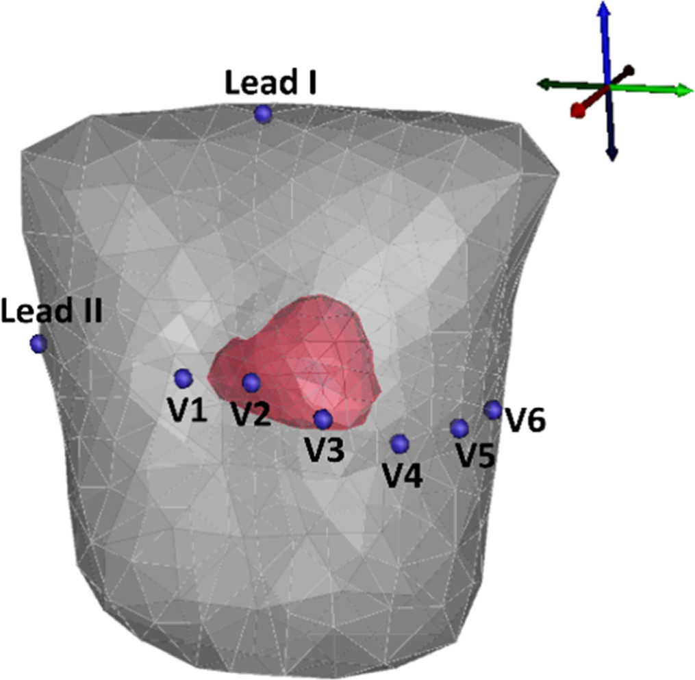 Forward problem of electrocardiography based on cardiac source vector ...