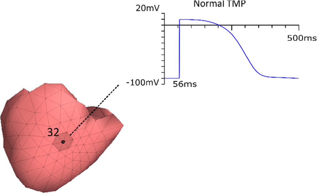 Forward problem of electrocardiography based on cardiac source vector ...