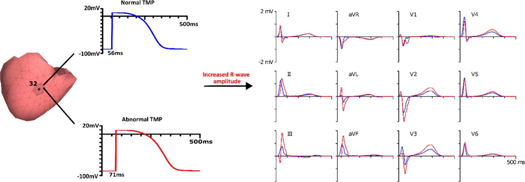 Forward problem of electrocardiography based on cardiac source vector ...