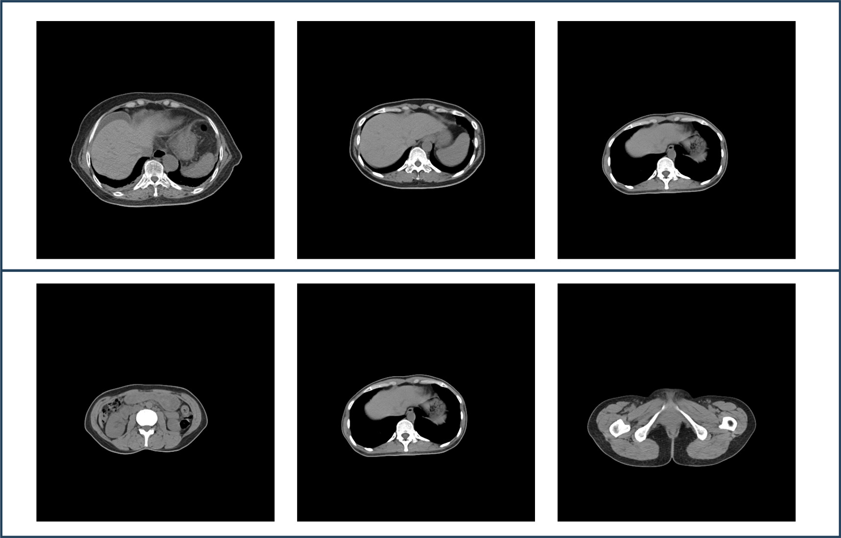 Synthetic CT generation from CBCT based on structural constraint cycle ...