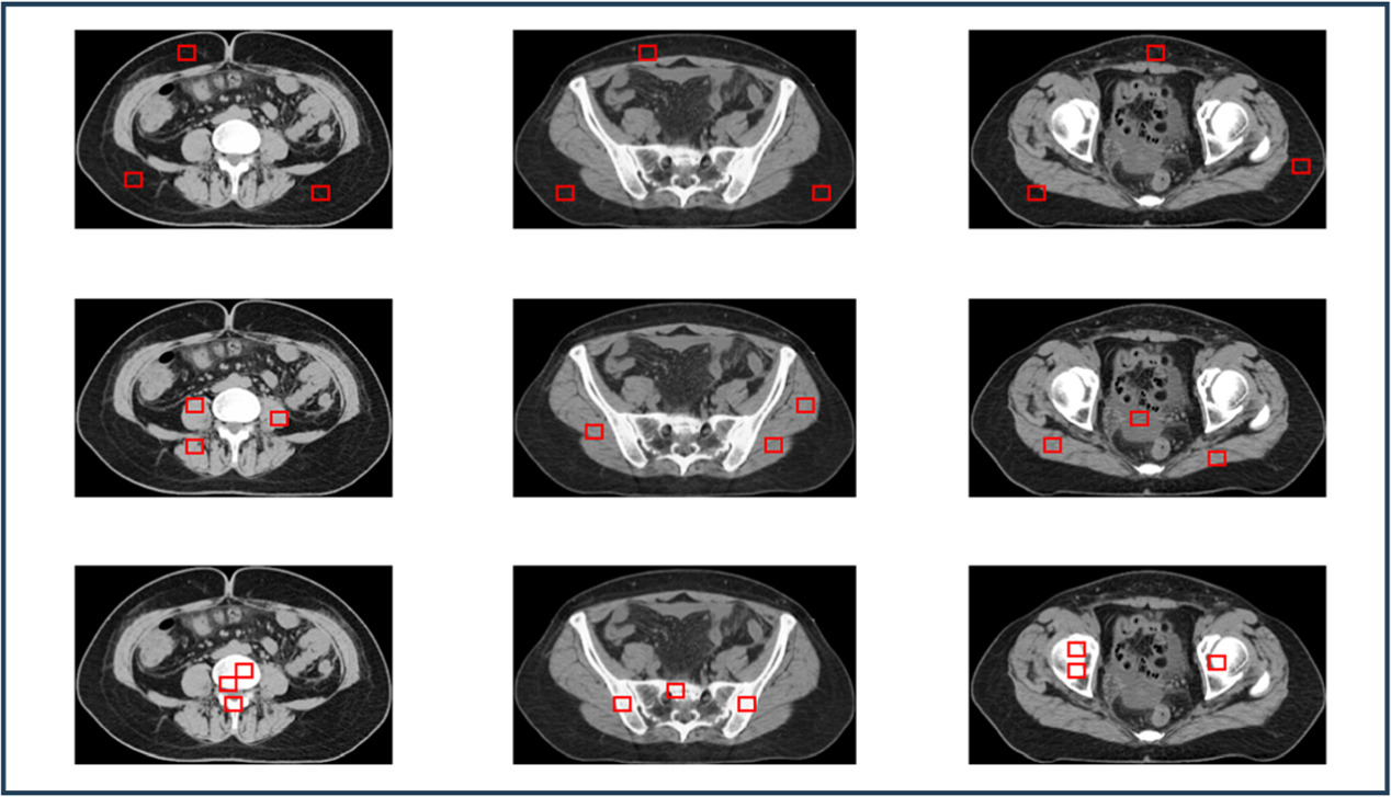 Synthetic CT generation from CBCT based on structural constraint cycle ...