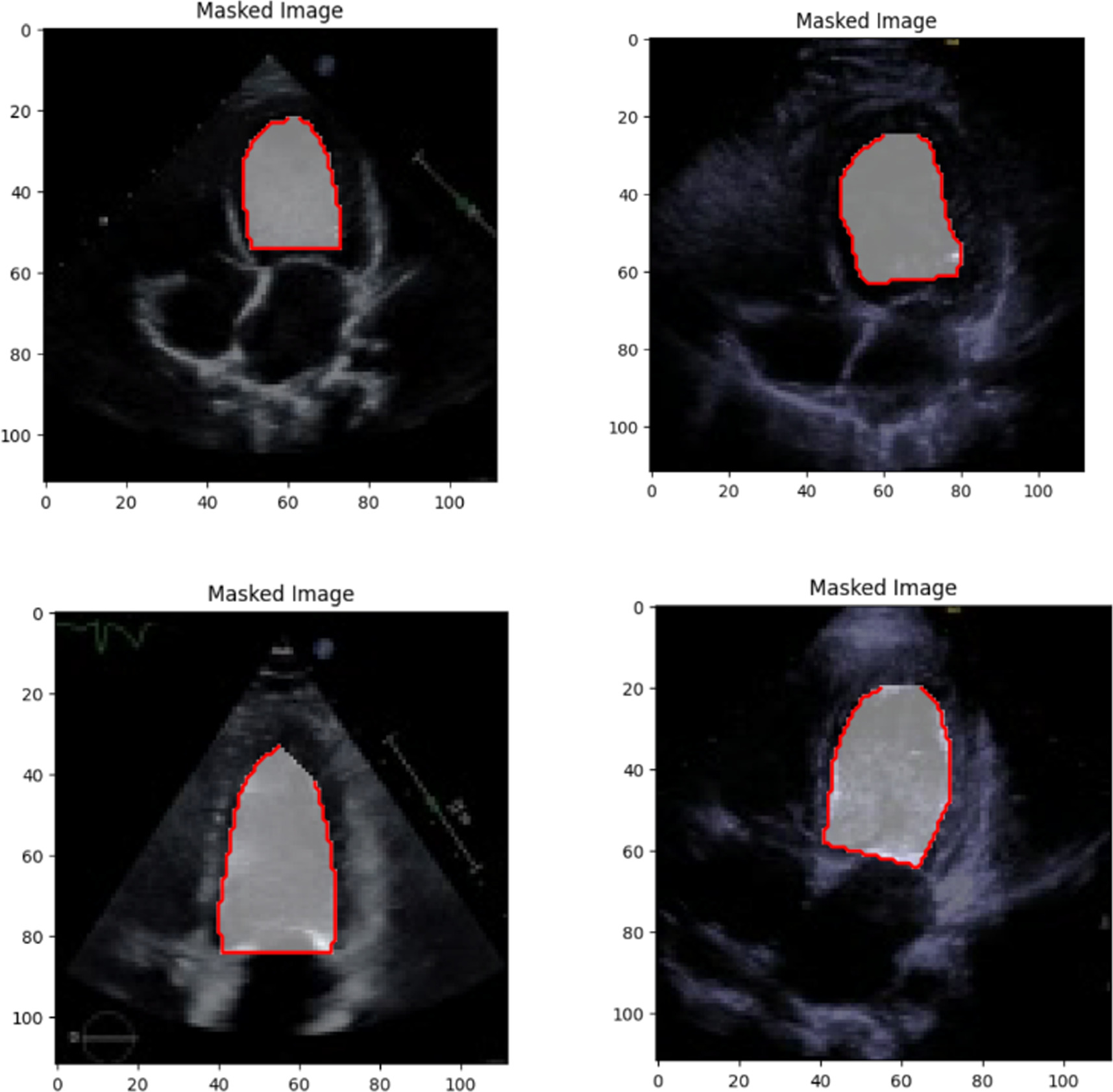 Automatic segmentation of echocardiographic images using a shifted ...