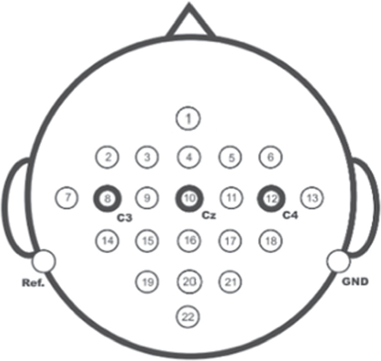 A class alignment network based on self-attention for cross-subject EEG ...