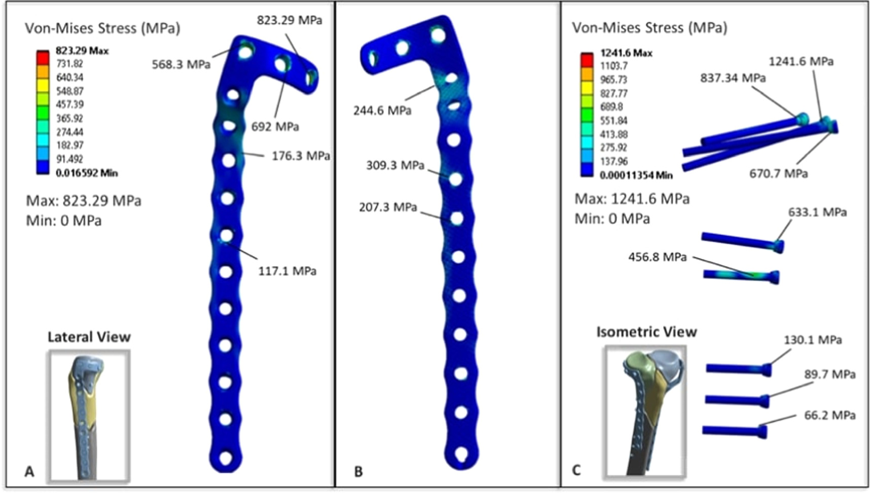 Comparative finite element analysis between three surgical techniques ...