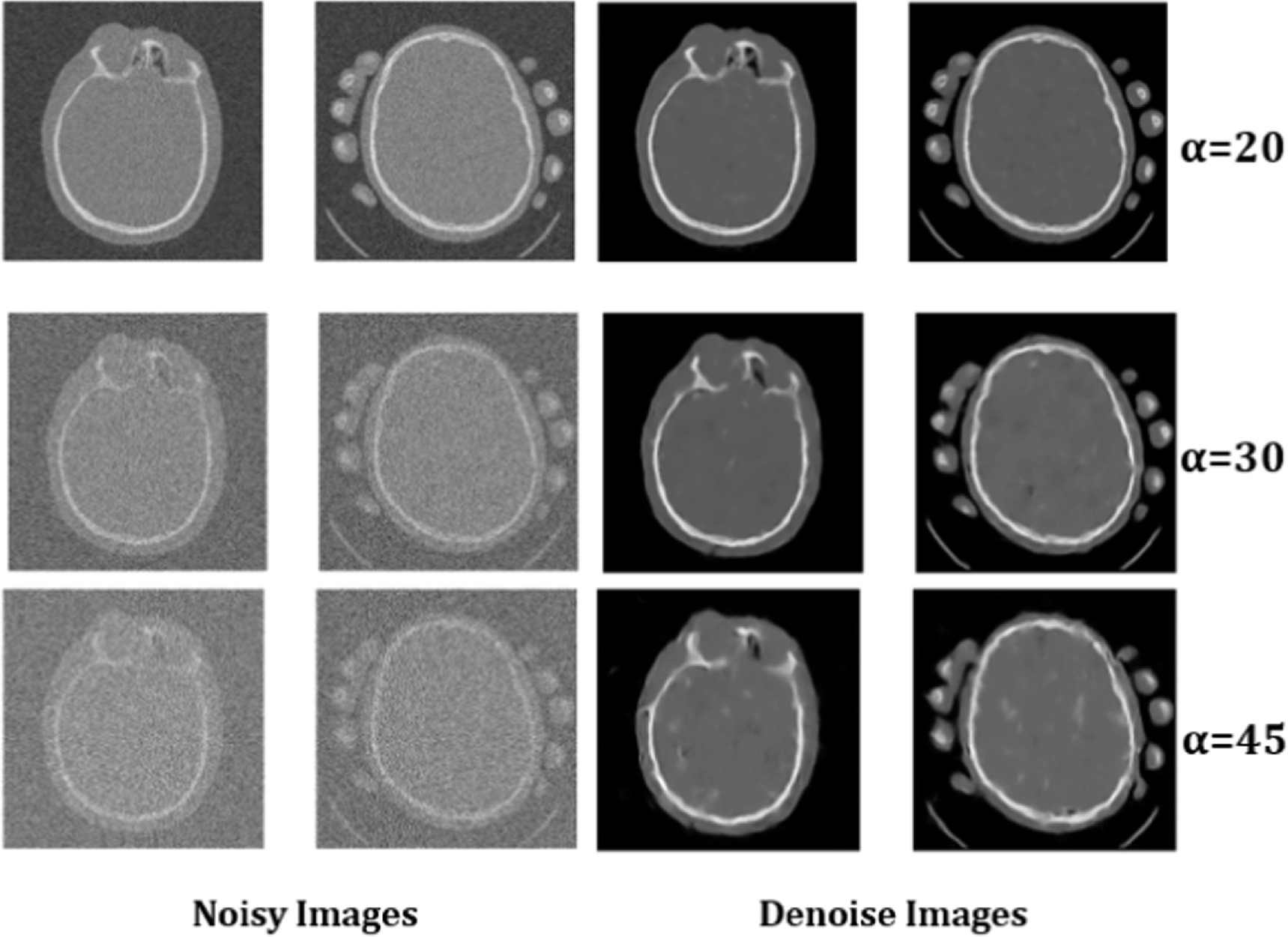 A variational network for biomedical images denoising using bayesian ...