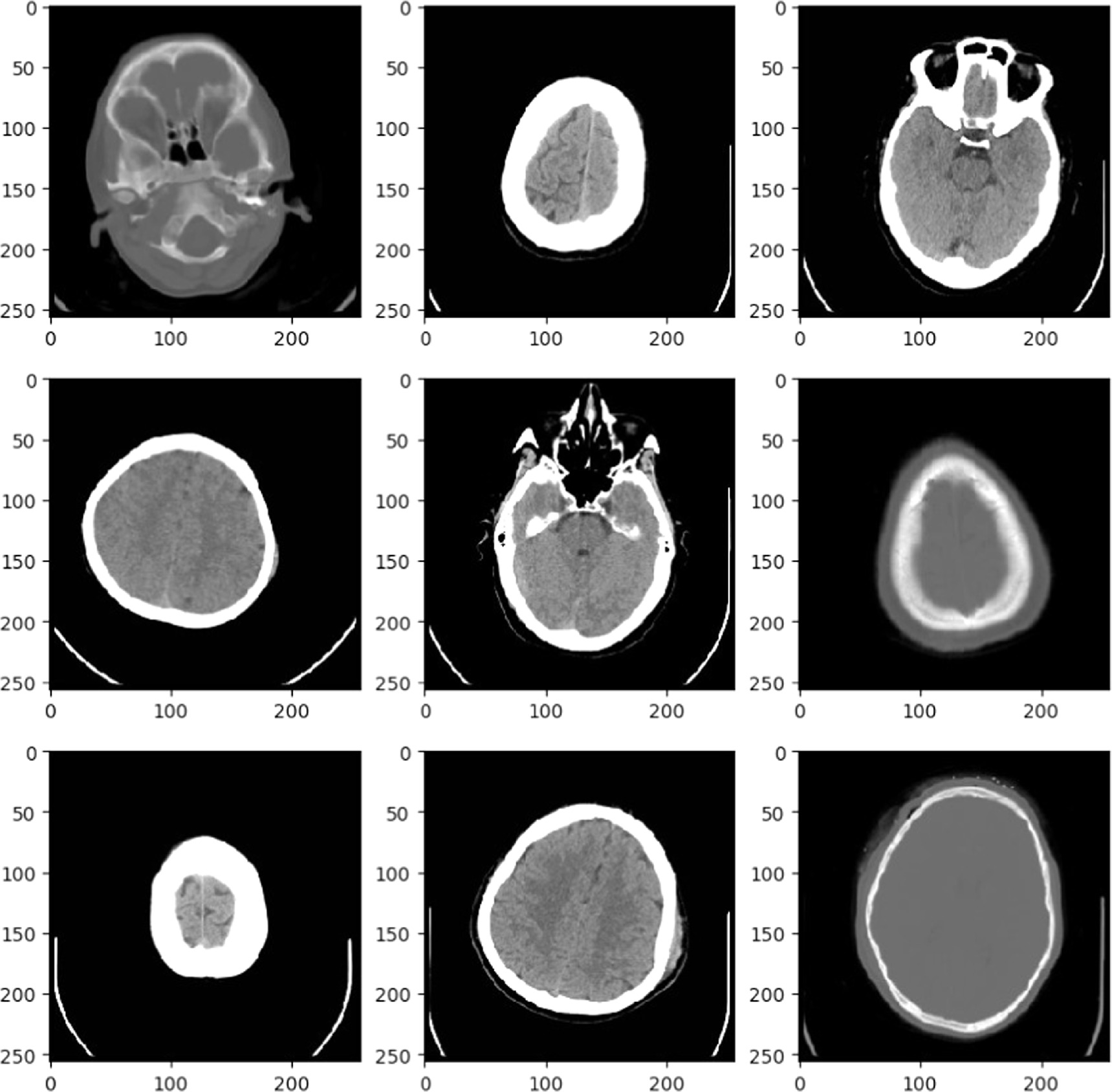 A variational network for biomedical images denoising using bayesian ...