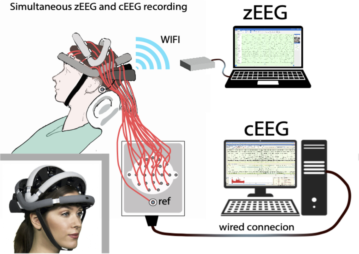 Technical validation of the Zeto wireless, dry electrode EEG