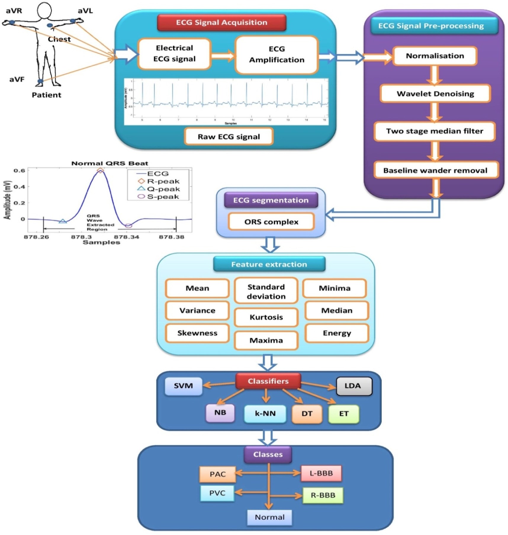 Automated classification of cardiac arrhythmia using short-duration ECG ...