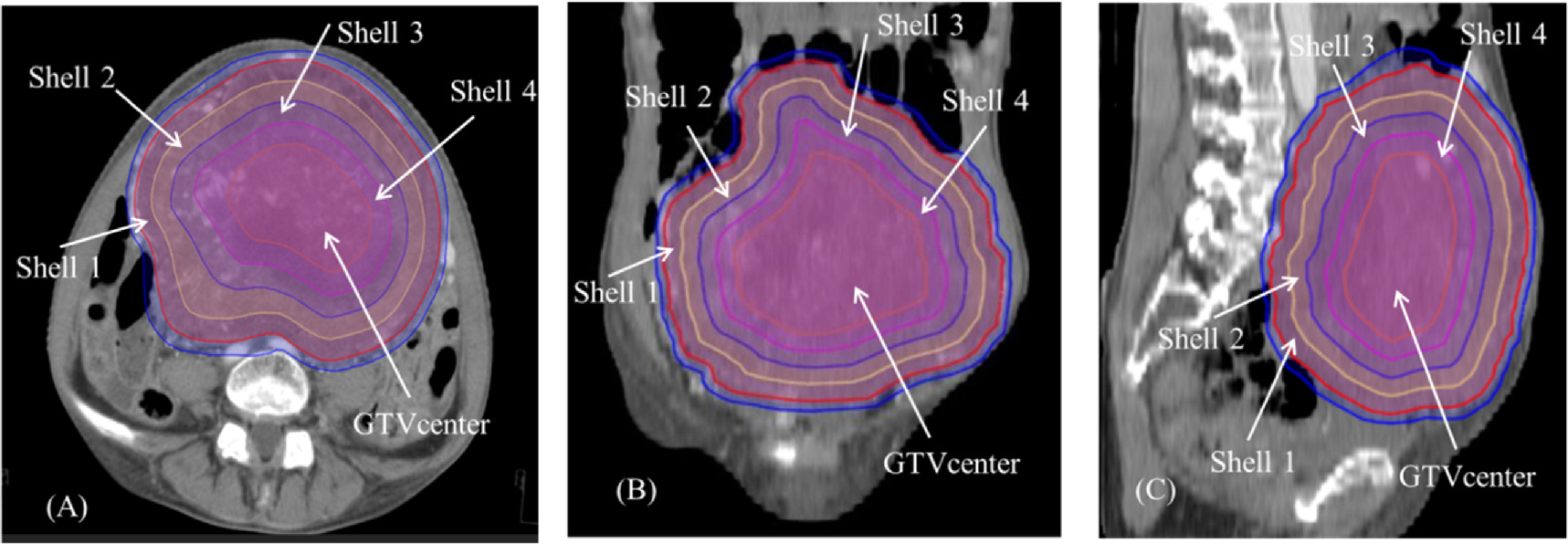Feasibility study of synchronously increasing dose of multi-shell ...