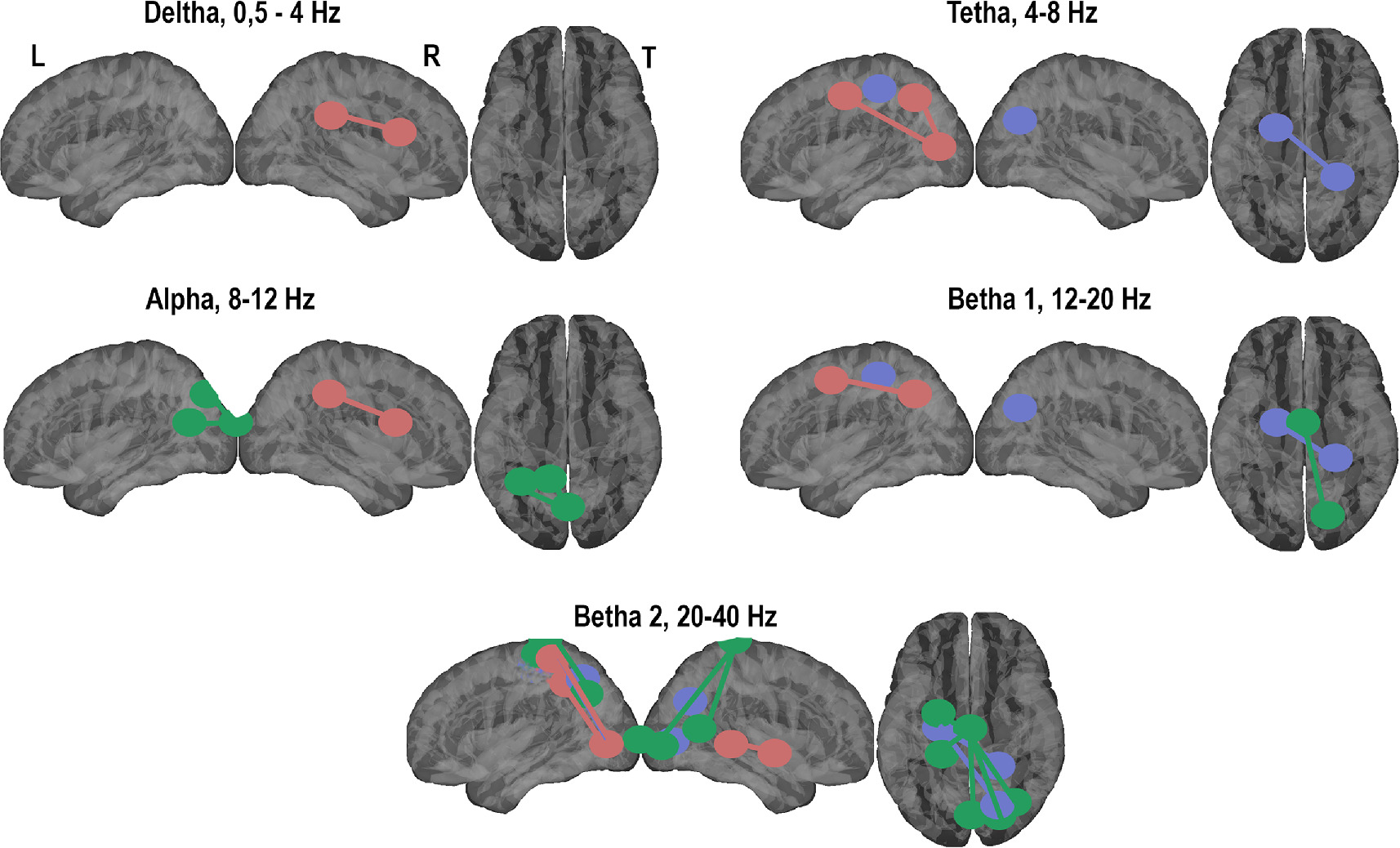 Alterations in functional connectivity of the brain during postural ...