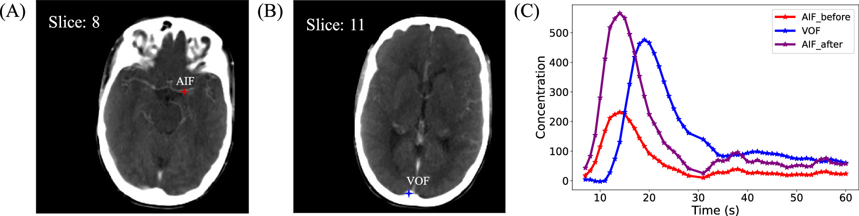A deep learning approach for quantifying CT perfusion parameters in ...