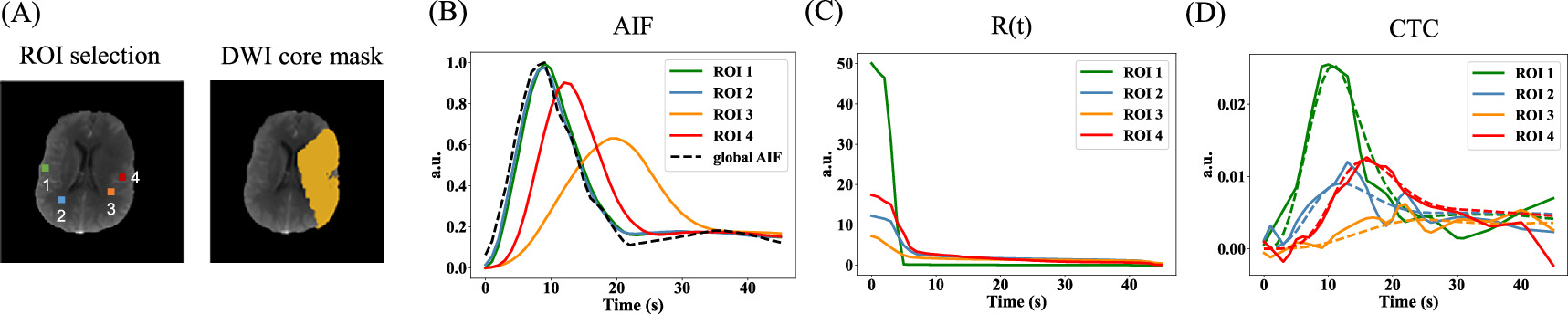 A deep learning approach for quantifying CT perfusion parameters in ...